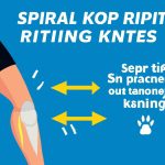 Stride Smart: Essential Tips to Prevent Knee Pain and Perfect Your Running Posture